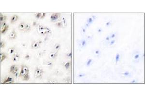 Immunohistochemistry analysis of paraffin-embedded human brain tissue, using Amylin Antibody. (Amylin/DAP antibody  (AA 1-50))