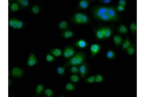 Immunofluorescence staining of Hela cells with ABIN7171794 at 1:266, counter-stained with DAPI. (TES antibody  (AA 130-260))