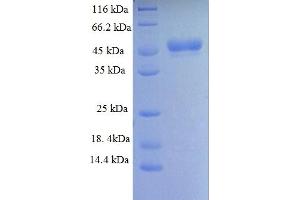 SDS-PAGE (SDS) image for Histone Deacetylase 4 (HDAC4) (AA 1-227), (partial) protein (GST tag) (ABIN4976269) (HDAC4 Protein (AA 1-227, partial) (GST tag))