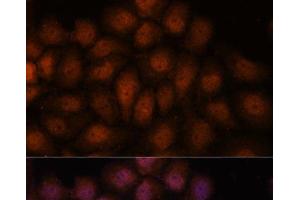 Immunofluorescence analysis of HeLa cells using IPO8 Polyclonal Antibody at dilution of 1:100. (Importin 8 antibody)