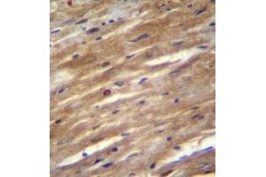 Immunohistochemistry analysis in formalin fixed and paraffin embedded mouse heart tissue reacted with FSD2 Antibody (N-term) followed by peroxidase conjugation of the secondary antibody and DAB staining.