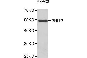 Western blot analysis of extracts of BxPC-3 cells, using PNLIP antibody (ABIN5975718) at 1/1000 dilution. (PNLIP antibody)