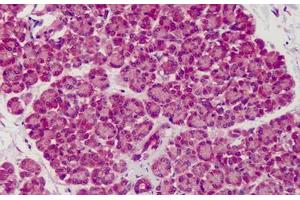 Human Pancreas: Formalin-Fixed, Paraffin-Embedded (FFPE) (SLIT1 antibody  (AA 487-504))