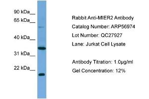 WB Suggested Anti-MIER2  Antibody Titration: 0. (MIER2 antibody  (Middle Region))
