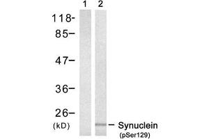 Western blot analysis of extract from mouse brain tissue, using α -Synuclein (phospho-Ser129) antibody (E011171). (SNCA antibody  (pSer129))