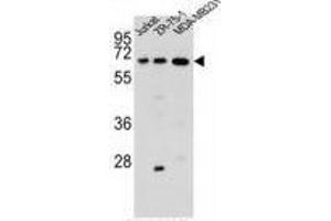 ZSCAN2 Antibody (N-term) western blot analysis in Jurkat,ZR-75-1, MDA-MB231 cell line lysates (35 µg/lane). (ZSCAN2 antibody  (N-Term))