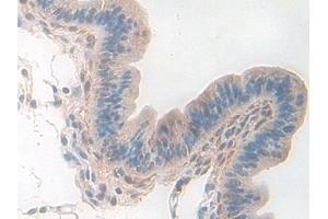 Immunohistochemistry (IHC) image for anti-Pyridoxal Kinase (PDXK) (AA 29-285) antibody (ABIN7441904)