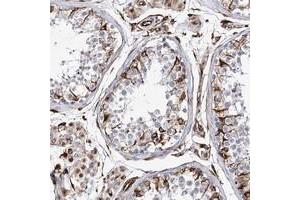 Immunohistochemical staining of human testis with ALG1L polyclonal antibody  shows strong cytoplasmic positivity in Sertoli and Leydig cells at 1:50-1:200 dilution. (ALG1L antibody)
