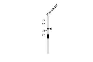 Anti-OPRM1 Antibody (Center) at 1:500 dilution + MDA-MB-231 whole cell lysate Lysates/proteins at 20 μg per lane.
