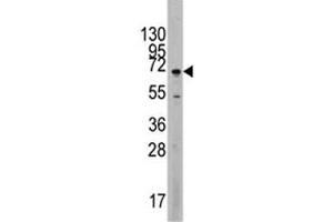Western blot analysis of MAPK4 antibody and Jurkat lysate. (MAPK4 antibody  (AA 537-566))
