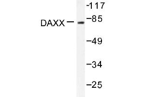 Image no. 1 for anti-Death-Domain Associated Protein (DAXX) antibody (ABIN271883) (DAXX antibody)
