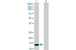 Western Blot analysis of MED22 expression in transfected 293T cell line by MED22 MaxPab polyclonal antibody.
