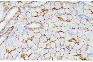 Immunohistochemistry of paraffin-embedded Mouse kidney using IFITM1 Polyclonal Antibody at dilution of 1:100 (40x lens). (IFITM1 antibody)