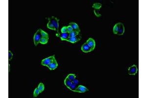 Immunofluorescent analysis of PC-3 cells cells using ABIN7168673 at dilution of 1:100 and Alexa Fluor 488-congugated AffiniPure Goat Anti-Rabbit IgG(H+L) (SECTM1 antibody  (AA 29-145))