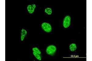 Immunofluorescence of monoclonal antibody to NFATC3 on HeLa cell. (NFATC3 antibody  (AA 70-149))