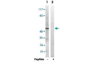 Western blot analysis of extracts from HT-29 cells, using APLF polyclonal antibody . (APLF antibody  (Ser116))