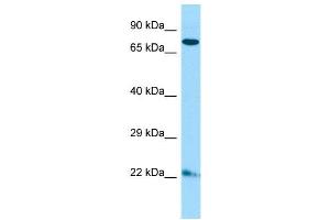 Host:  Rabbit  Target Name:  Zfp74  Sample Type:  Mouse Lung lysates  Antibody Dilution:  1.