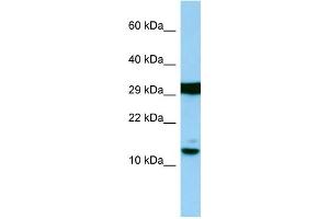 Host: Rabbit Target Name: H2AFJ Sample Type: RPMI-8226 Whole Cell lysates Antibody Dilution: 1. (H2AFJ antibody  (N-Term))