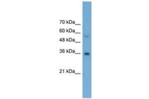 Image no. 1 for anti-UDP-Galactose-4-Epimerase (GALE) (AA 201-250) antibody (ABIN6745564)