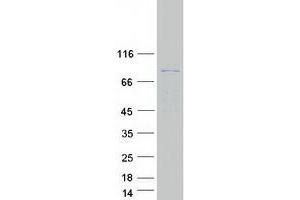 Western Blotting (WB) image for Phosphorylase, Glycogen, Muscle (PYGM) (Transcript Variant 2) protein (Myc-DYKDDDDK Tag) (ABIN2722042)