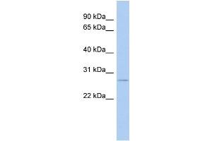 WB Suggested Anti-NRM Antibody Titration: 0. (Nurim antibody  (N-Term))