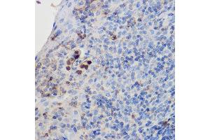 Immunohistochemistry of paraffin-embedded human tonsil using IL17A Rabbit pAb (ABIN6128129, ABIN6142315, ABIN6142317 and ABIN6216088) at dilution of 1:200 (40x lens).