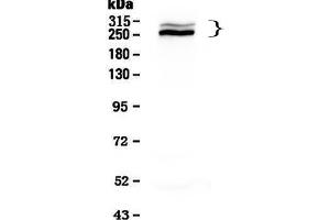 Western blot analysis of Desmoplakin using anti-Desmoplakin antibody .