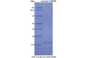 SDS-PAGE (SDS) image for Fatty Acid Binding Protein 5 (Psoriasis-Associated) (FABP5) (AA 2-135) protein (His tag) (ABIN1079489) (FABP5 Protein (AA 2-135) (His tag))