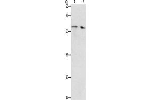 Gel: 10 % SDS-PAGE, Lysate: 40 μg, Lane 1-2: Human liver cancer tissue, Human fetal liver tissue, Primary antibody: ABIN7192673(STEAP4 Antibody) at dilution 1/450, Secondary antibody: Goat anti rabbit IgG at 1/8000 dilution, Exposure time: 40 seconds (STEAP4 antibody)