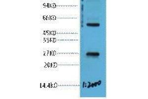 Western Blot (WB) analysis of 293T cell lysate, diluted at 1:2000. (EFHD1 antibody)