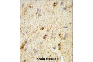Formalin-fixed and paraffin-embedded human brain tissue reacted with QDPR Antibody (C-term), which was peroxidase-conjugated to the secondary antibody, followed by DAB staining.