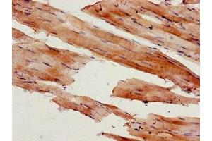 Immunohistochemistry of paraffin-embedded human skeletal muscle tissue using ABIN7160555 at dilution of 1:100 (MYL9 antibody  (AA 2-172))