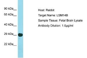Host: Rabbit Target Name: LSM14B Sample Type: Fetal Brain lysates Antibody Dilution: 1. (LSM14B antibody  (N-Term))