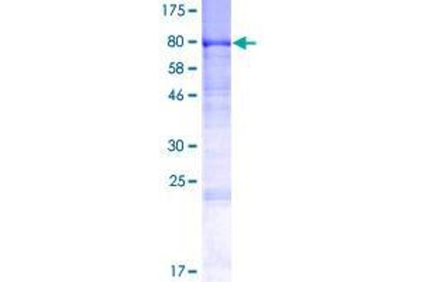 DENND1A Protein (AA 1-559) (GST tag)