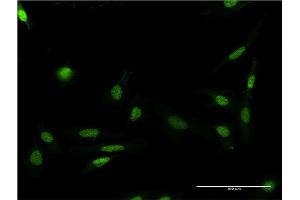 Immunofluorescence of monoclonal antibody to FASTK on HeLa cell. (FASTK antibody  (AA 67-154))