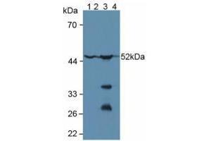 Figure. (Glutathione Synthetase antibody  (AA 268-474))