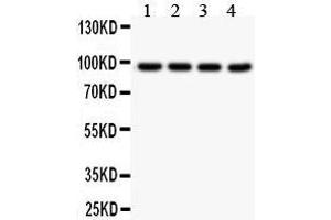 Anti- SLC6A4 Picoband antibody, Western blotting All lanes: Anti SLC6A4  at 0. (SLC6A4 antibody  (N-Term))