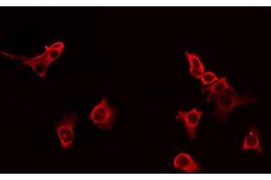 ABIN6266938 staining HT29 by IF/ICC. (GPRIN1 antibody  (Internal Region))