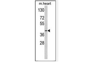 Image no. 3 for anti-Medium-Chain Specific Acyl-CoA Dehydrogenase, Mitochondrial (MCAD) (AA 196-225) antibody (ABIN452704) (Medium-Chain Specific Acyl-CoA Dehydrogenase, Mitochondrial (MCAD) (AA 196-225) antibody)