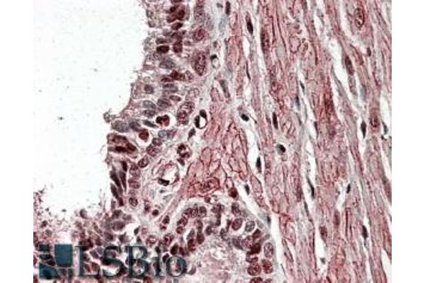 ZNF217 antibody  (Internal Region)