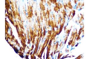 Immunohistochemistry of paraffin-embedded mouse heart using Cardiac Cardiac troponin T (TNNT2) (TNNT2) Rabbit mAb (ABIN7266088) at dilution of 1:100 (40x lens). (Cardiac Troponin T2 antibody)