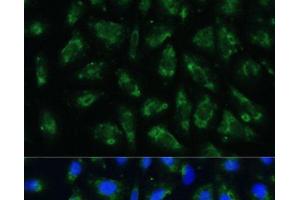 Immunofluorescence analysis of U-2 OS cells using APOB Polyclonal Antibody at dilution of 1:100. (APOB antibody)