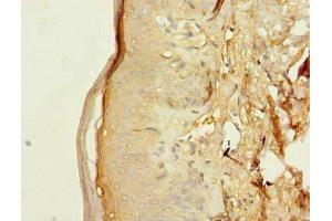 Immunohistochemistry of paraffin-embedded human skin tissue using ABIN7173099 at dilution of 1:100 (TMEM176B antibody  (AA 1-64))