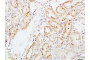 Paraformaldehyde-fixed, paraffin embedded rat kidney, Antigen retrieval by boiling in sodium citrate buffer (pH6) for 15min, Block endogenous peroxidase by 3% hydrogen peroxide for 30 minutes, Blocking buffer (normal goat serum) at 37°C for 20min, Antibody incubation with EPO Polyclonal Antibody, Unconjugated  ) at 1:200 overnight at 4°C, followed by a conjugated secondary and DAB staining. (EPO antibody  (AA 101-193))