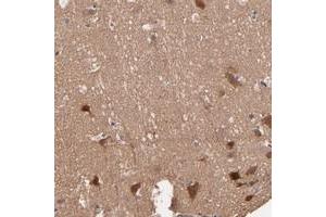 Immunohistochemical staining of human cerebral cortex with STAP2 polyclonal antibody  shows strong cytoplasmic positivity in neuronal cells.