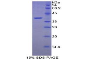 SDS-PAGE analysis of Human Calcineurin Protein.