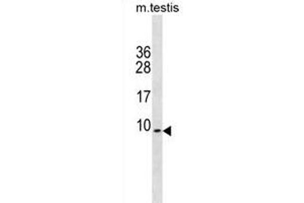 PDE6H antibody  (AA 4-33)
