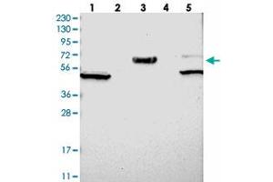Western blot analysis of Lane 1: RT-4, Lane 2: U-251 MG, Lane 3: Human Plasma, Lane 4: Liver, Lane 5: Tonsil with WSCD2 polyclonal antibody . (WSCD2 antibody)