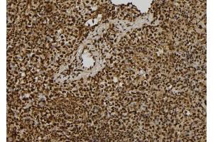 ABIN6279422 at 1/100 staining Mouse spleen tissue by IHC-P. (EIF3A antibody  (C-Term))