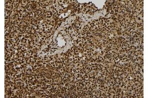ABIN6279422 at 1/100 staining Mouse spleen tissue by IHC-P.